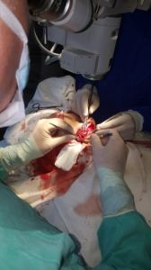 Intervenție chirurgicală în premieră