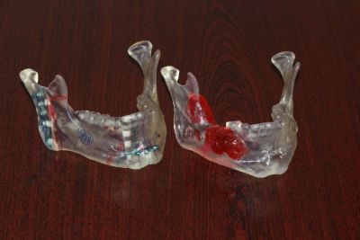 Intervenție chirurgicală în premieră